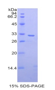 PITRM1 / MP1 Protein - Recombinant Pitrilysin Metalloproteinase 1 By SDS-PAGE