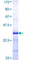 PITX1 Protein - 12.5% SDS-PAGE Stained with Coomassie Blue