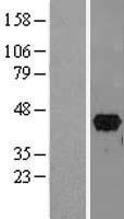 PITX2 / RGS Protein - Western validation with an anti-DDK antibody * L: Control HEK293 lysate R: Over-expression lysate