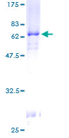 PITX2 / RGS Protein - 12.5% SDS-PAGE of human PITX2 stained with Coomassie Blue