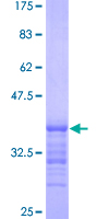 PITX2 / RGS Protein - 12.5% SDS-PAGE Stained with Coomassie Blue.