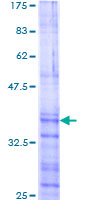 PITX2 / RGS Protein - 12.5% SDS-PAGE Stained with Coomassie Blue