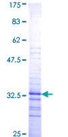 PITX2 / RGS Protein - 12.5% SDS-PAGE Stained with Coomassie Blue.