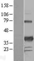 PITX3 Protein - Western validation with an anti-DDK antibody * L: Control HEK293 lysate R: Over-expression lysate