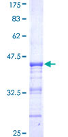 PJA1 / PRAJA1 Protein - 12.5% SDS-PAGE Stained with Coomassie Blue.