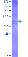 PK2 / PROK2 Protein - 12.5% SDS-PAGE Stained with Coomassie Blue.