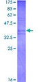 PK2 / PROK2 Protein - 12.5% SDS-PAGE Stained with Coomassie Blue.