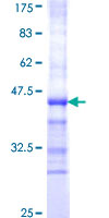 PKD1 / Polycystin Protein - 12.5% SDS-PAGE Stained with Coomassie Blue