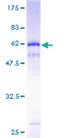 PKD1L2 Protein - 12.5% SDS-PAGE of human PKD1L2 stained with Coomassie Blue