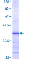 PKD2 / Polycystin 2 Protein - 12.5% SDS-PAGE Stained with Coomassie Blue.