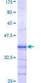 PKD2 / Polycystin 2 Protein - 12.5% SDS-PAGE Stained with Coomassie Blue.