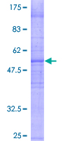 PKD2L1 Protein - 12.5% SDS-PAGE of human PKD2L1 stained with Coomassie Blue