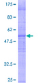 PKD2L1 Protein - 12.5% SDS-PAGE of human PKD2L1 stained with Coomassie Blue