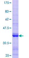 PKD2L1 Protein - 12.5% SDS-PAGE Stained with Coomassie Blue.