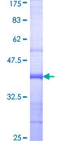 PKD3 / PRKD3 Protein - 12.5% SDS-PAGE Stained with Coomassie Blue.