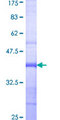 PKD3 / PRKD3 Protein - 12.5% SDS-PAGE Stained with Coomassie Blue.