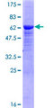 PKDCC / SGK493 Protein - 12.5% SDS-PAGE of human LOC91461 stained with Coomassie Blue