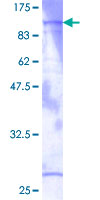 PKG / PRKG1 Protein - 12.5% SDS-PAGE of human PRKG1 stained with Coomassie Blue