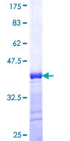 PKG / PRKG1 Protein - 12.5% SDS-PAGE Stained with Coomassie Blue.