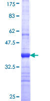 PKHD1L1 Protein - 12.5% SDS-PAGE Stained with Coomassie Blue.