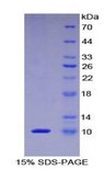 PKIA Protein - Recombinant Protein Kinase Inhibitor Alpha By SDS-PAGE