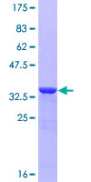 PKIB Protein - 12.5% SDS-PAGE of human PKIB stained with Coomassie Blue