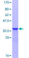 PKIB Protein - 12.5% SDS-PAGE of human PKIB stained with Coomassie Blue