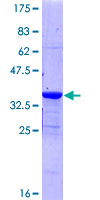 PKIG Protein - 12.5% SDS-PAGE of human PKIG stained with Coomassie Blue