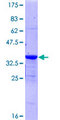 PKIG Protein - 12.5% SDS-PAGE of human PKIG stained with Coomassie Blue