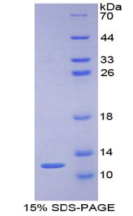 PKIG Protein - Recombinant Protein Kinase Inhibitor Gamma By SDS-PAGE