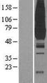 PKLR Protein - Western validation with an anti-DDK antibody * L: Control HEK293 lysate R: Over-expression lysate