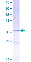 PKLR Protein - 12.5% SDS-PAGE Stained with Coomassie Blue.