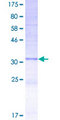 PKLR Protein - 12.5% SDS-PAGE Stained with Coomassie Blue.