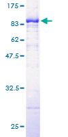 PKM / Pyruvate Kinase, Muscle Protein - 12.5% SDS-PAGE of human PKM2 stained with Coomassie Blue