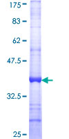 PKM / Pyruvate Kinase, Muscle Protein - 12.5% SDS-PAGE Stained with Coomassie Blue.