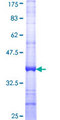 PKM / Pyruvate Kinase, Muscle Protein - 12.5% SDS-PAGE Stained with Coomassie Blue.