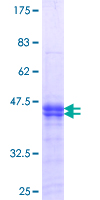 PKMYT1 Protein - 12.5% SDS-PAGE Stained with Coomassie Blue.