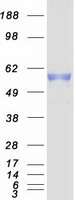 PKMYT1 Protein - Purified recombinant protein PKMYT1 was analyzed by SDS-PAGE gel and Coomassie Blue Staining