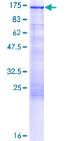 PKN1 Protein - 12.5% SDS-PAGE of human PKN1 stained with Coomassie Blue