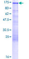 PKN1 Protein - 12.5% SDS-PAGE of human PKN1 stained with Coomassie Blue