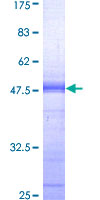PKN1 Protein - 12.5% SDS-PAGE Stained with Coomassie Blue.