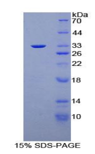 PKN1 Protein - Recombinant Protein Kinase N1 By SDS-PAGE