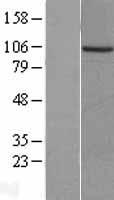 PKN3 Protein - Western validation with an anti-DDK antibody * L: Control HEK293 lysate R: Over-expression lysate