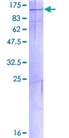 PKN3 Protein - 12.5% SDS-PAGE of human PKN3 stained with Coomassie Blue