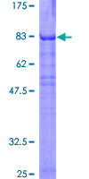 PKNOX1 / PREP1 Protein - 12.5% SDS-PAGE of human PKNOX1 stained with Coomassie Blue