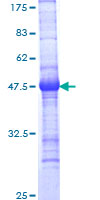 PKNOX1 / PREP1 Protein - 12.5% SDS-PAGE Stained with Coomassie Blue.