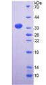 PKP2 / Plakophilin 2 Protein - Recombinant Plakophilin 2 By SDS-PAGE
