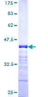 PKP4 / Plakophilin 4 Protein - 12.5% SDS-PAGE Stained with Coomassie Blue.