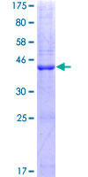 PLA2G10 Protein - 12.5% SDS-PAGE of human PLA2G10 stained with Coomassie Blue