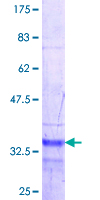 PLA2G10 Protein - 12.5% SDS-PAGE Stained with Coomassie Blue.